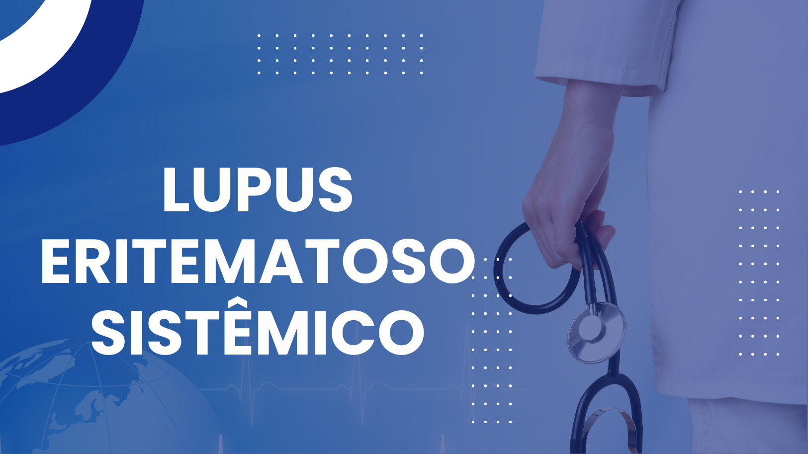 Lupus Eritematoso Sistêmico