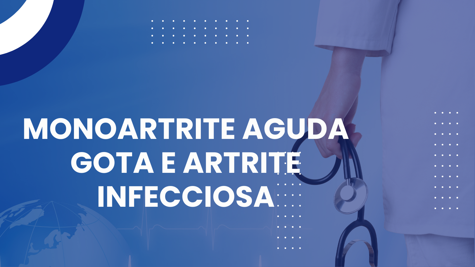 Monoartrite aguda – gota e artrite infecciosa