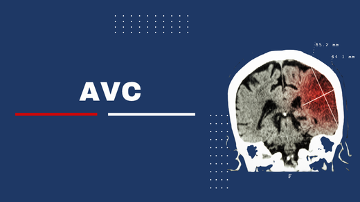 Acidente Vascular Encefálico