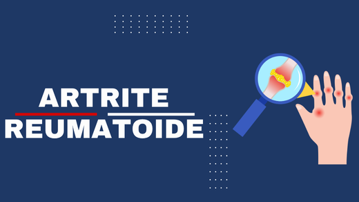 Artrite reumatoide