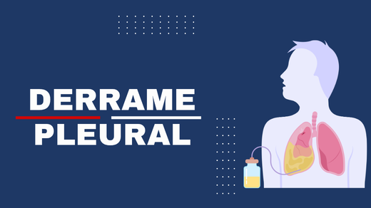 Derrame Pleural