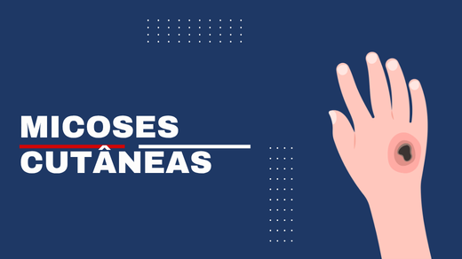 Micoses Cutâneas