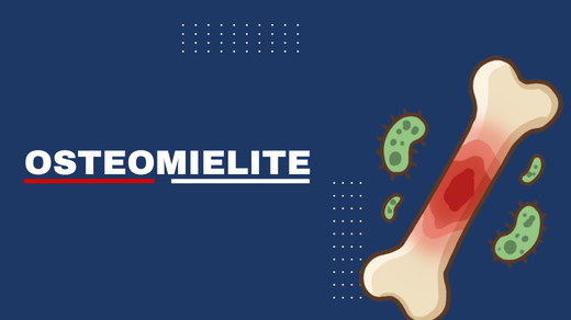 Osteomielite
