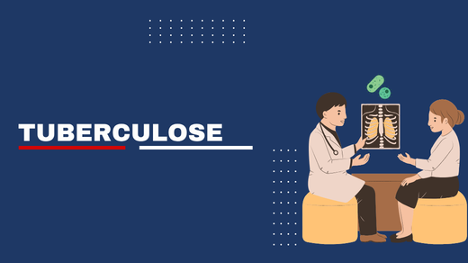 Tuberculose