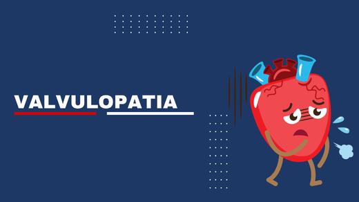 Valvulopatia