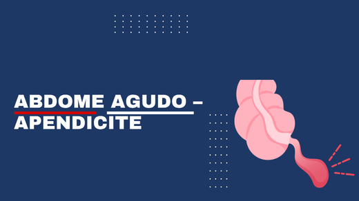 Abdome Agudo – Apendicite
