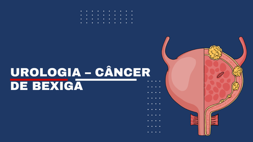 Urologia – Câncer De Bexiga