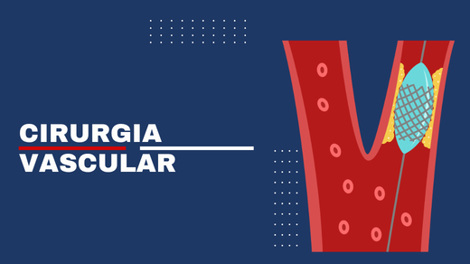Cirurgia Vascular
