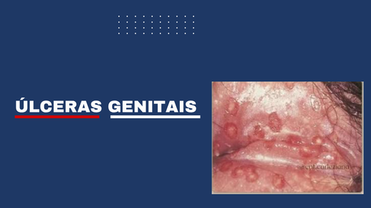 Úlceras Genitais