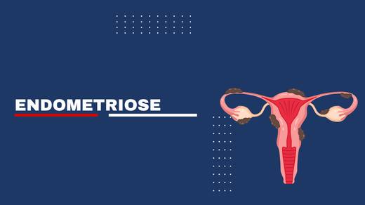 Endometriose
