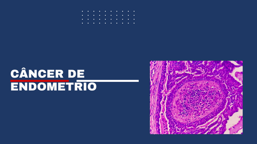 Câncer De Endometrio